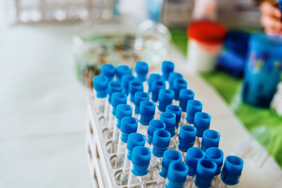 Many test tubes with blue plugs in a rack full of scientific experiments.